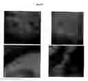 Fig. 55 - Methods and products for producing lattices of EMR-treated islets in tissues, and uses therefor