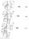 Fig. 32 - Methods and products for producing lattices of EMR-treated islets in tissues, and uses therefor