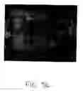 Fig. 52 - Methods and products for producing lattices of EMR-treated islets in tissues, and uses therefor