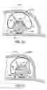 Fig. 17 - Apparatus and method for diagnosis and therapy of electrophysiological disease