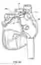 Fig. 20 - Apparatus and method for diagnosis and therapy of electrophysiological disease