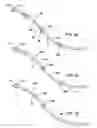 Fig. 23 - Apparatus and method for diagnosis and therapy of electrophysiological disease