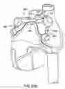 Fig. 25 - Apparatus and method for diagnosis and therapy of electrophysiological disease