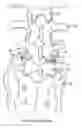 Fig. 01 - Facet joint fusion devices and methods
