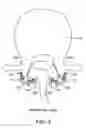Fig. 03 - Facet joint fusion devices and methods