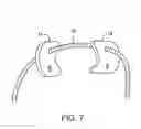 Fig. 07 - Facet joint fusion devices and methods