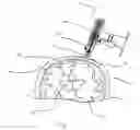 Fig. 02 - Method and medical device for rapid and accurate entry through soft tissue and bone