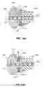 Fig. 07 - Device for inserting implants