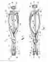 Fig. 02 - Insertion instrument for cervical prostheses