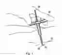 Fig. 02 - Sequential dilator system