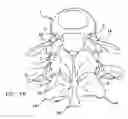 Fig. 03 - Facet joint replacement