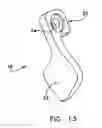 Fig. 15 - Facet joint replacement