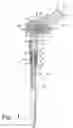 Fig. 02 - Adjustable orthopaedic prosthesis and associated method