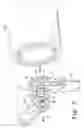 Fig. 07 - Adjustable orthopaedic prosthesis and associated method