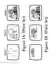 Fig. 02 - Sequential decoding of progressive coded JPEGs