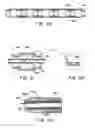 Fig. 07 - Cryosurgical catheter