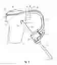 Fig. 04 - Tethered joint bearing implants and systems