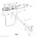 Fig. 06 - Tethered joint bearing implants and systems