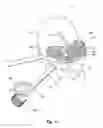 Fig. 12 - Tethered joint bearing implants and systems