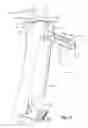Fig. 13 - Tethered joint bearing implants and systems
