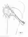 Fig. 18 - Tethered joint bearing implants and systems