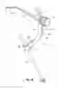 Fig. 21 - Tethered joint bearing implants and systems