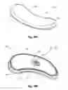 Fig. 23 - Tethered joint bearing implants and systems