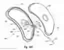 Fig. 24 - Tethered joint bearing implants and systems
