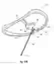 Fig. 26 - Tethered joint bearing implants and systems