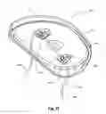 Fig. 30 - Tethered joint bearing implants and systems