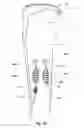 Fig. 40 - Tethered joint bearing implants and systems