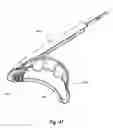 Fig. 44 - Tethered joint bearing implants and systems