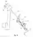 Fig. 48 - Tethered joint bearing implants and systems