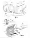 Fig. 49 - Tethered joint bearing implants and systems