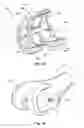 Fig. 51 - Tethered joint bearing implants and systems