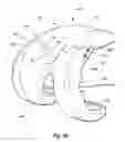 Fig. 54 - Tethered joint bearing implants and systems