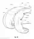 Fig. 56 - Tethered joint bearing implants and systems