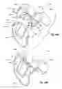 Fig. 57 - Tethered joint bearing implants and systems