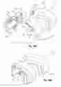 Fig. 58 - Tethered joint bearing implants and systems