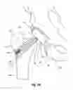 Fig. 59 - Tethered joint bearing implants and systems