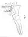 Fig. 61 - Tethered joint bearing implants and systems