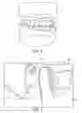 Fig. 06 - Method and system for preventing head injury