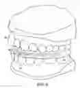 Fig. 08 - Method and system for preventing head injury