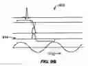 Fig. 09 - Imaging by magnetic resonance adsorption, elastography and tomography
