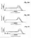 Fig. 06 - Fusing device with stable nipping portion