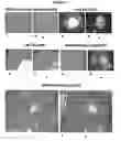 Fig. 04 - Compositions and methods for enrichment of neural stem cells using ceramide analogs