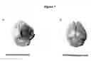 Fig. 06 - Compositions and methods for enrichment of neural stem cells using ceramide analogs