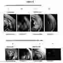 Fig. 07 - Compositions and methods for enrichment of neural stem cells using ceramide analogs