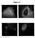 Fig. 08 - Compositions and methods for enrichment of neural stem cells using ceramide analogs