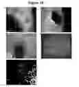 Fig. 09 - Compositions and methods for enrichment of neural stem cells using ceramide analogs
